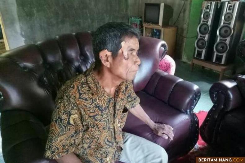 Warga bernama Soron (62) diserang beruang di sekitar rumahnya di Jorong Pinagar, Nagari Persiapan Pinagar Aur Kuning, Kecamatan Pasaman, Kabupaten Pasaman Barat, Sumatera Barat. Foto: IG (@bksda_sumbar)